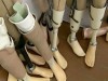 На Львівщині вояки зможуть отримати протези за спрощеною процедурою