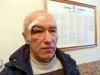У Львові побили активіста-антизабудовника