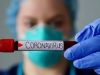 В Україні зафіксовано 73 випадки коронавірусу. Список