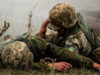 Український військовий на Донбасі отримав бойову травму