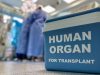 За два місяці львівські медики успішно пересадили 26 донорських органів
