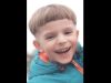 Експерти надали висновок щодо смерті 5-річного хлопчика після видалення зубів у Львові