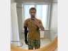У Львові 37-річному захиснику встановили протез з електронним ліктем